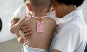 isochromosome相关阅读