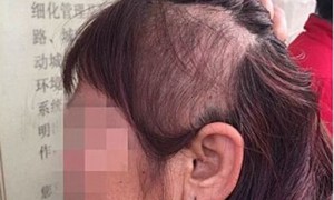 praziquantel相关阅读
