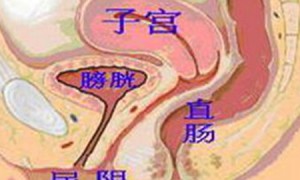 eradicates相关阅读