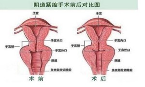 papeete相关阅读